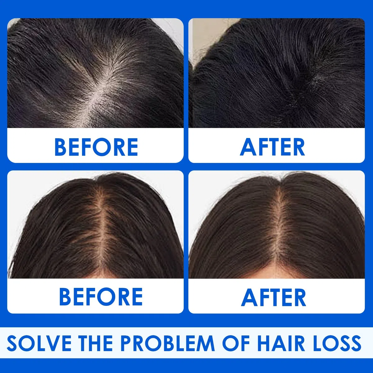 Siero Capelli Crescita Per Uomini e Donne,Essenza Per La Crescita Dei Capelli,Promuovere una Crescita dei Capelli più Spessa,Siero Capelli Crescita Adatto a Tutti i Tipi di Capelli-60ml