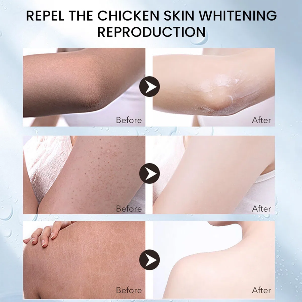 Crema alla Cheratosi, Crema Idratante alla Cheratosi, Soluzione Quotidiana per Della Pelle, Esfoliante Scrub Corpo Contro Cheratosis Pilare, Pelle a Fragola e peli Incarniti 30 G