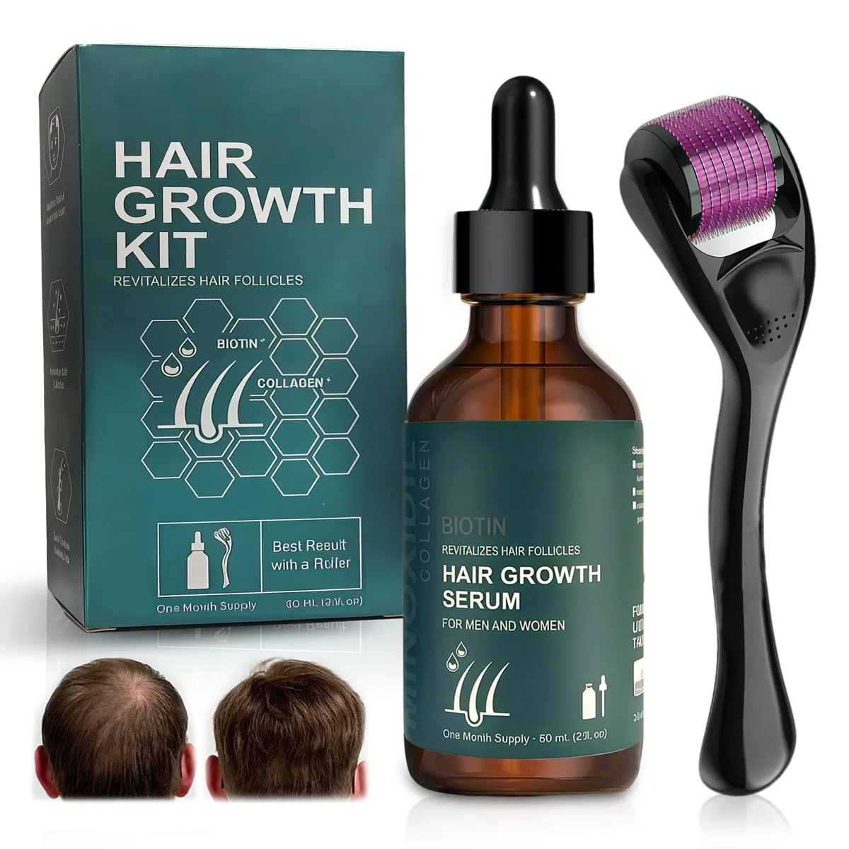 Kit crescita capelli Con Roller Set, Siero per La Crescita Dei Capelli, 60 ml siero per la crescita dei capelli, per Capelli Più Spessi, Lunghi per Uomini Donne