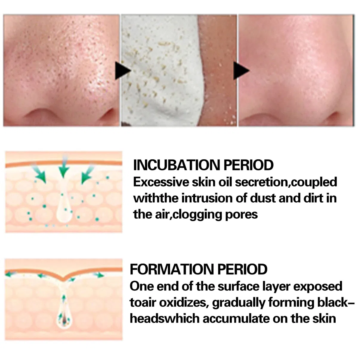 Maschera Punti Neri Rimozione, Blackhead Remover, per Viso, Cerotti Naso, Strisce Rimuovi Punti Neri, Deep Cleansing Pore Strips With 60 Sheets Papers, 30g