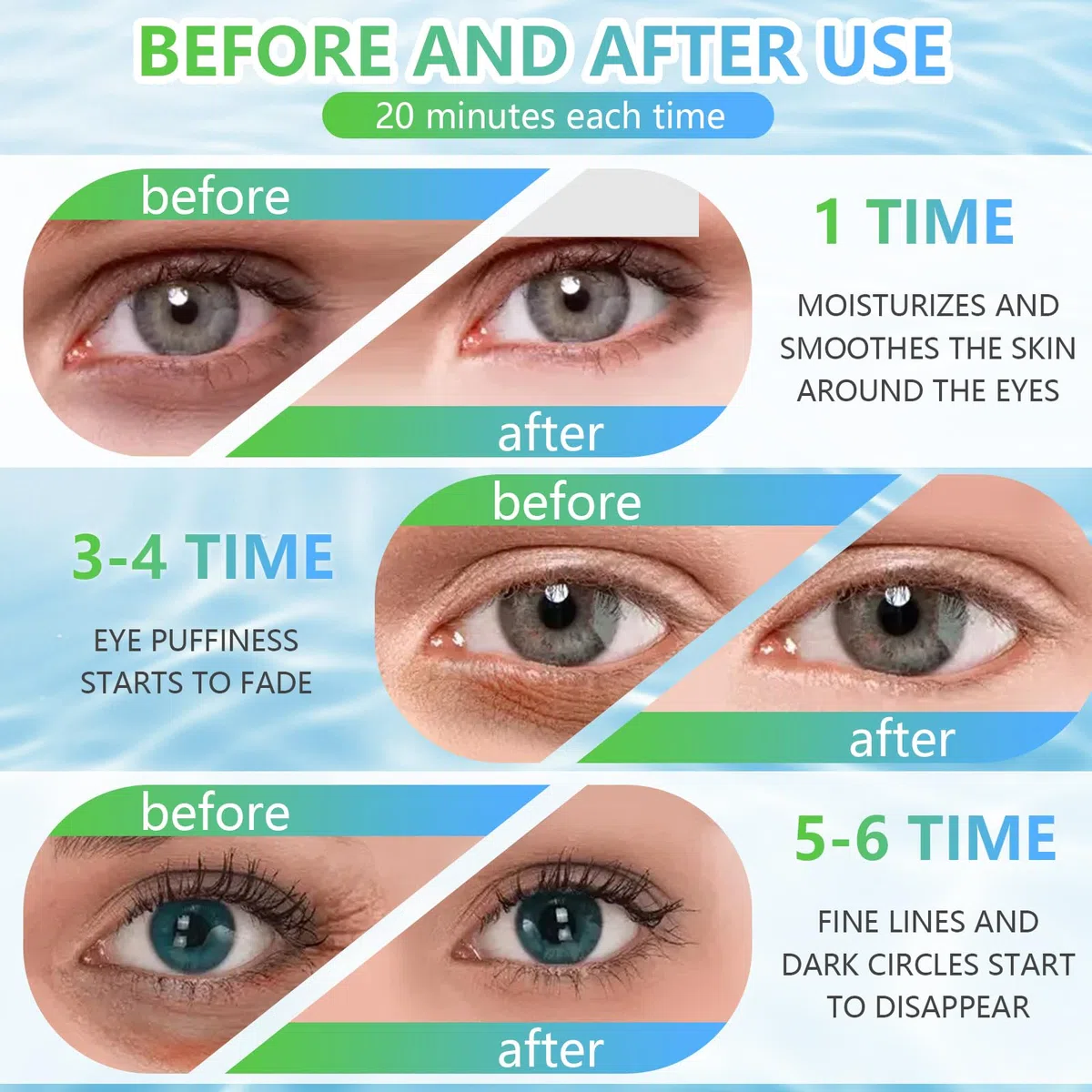 120 Pezzi Aloe Vera e con Caffeina Patch Occhi, Rassodanti & Idratanti Eye Patch, Aiuta a Schiarire Piccole Rughe e Occhiaie, Migliora la Condizione del Contorno Occhi, per la Cura Quotidiana(Blu)