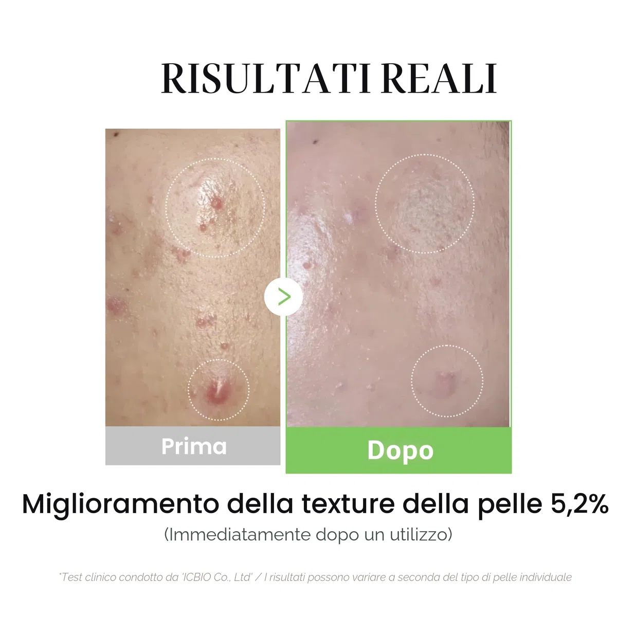 medicube - AMPOLLA CALMANTE POTENTE MA MORBIDO: lenisce tutti i problemi della pelle con esosomi contenenti Centella Asiatica che forniscono potenti effetti lenitivi e ammorbidiscono la consistenza