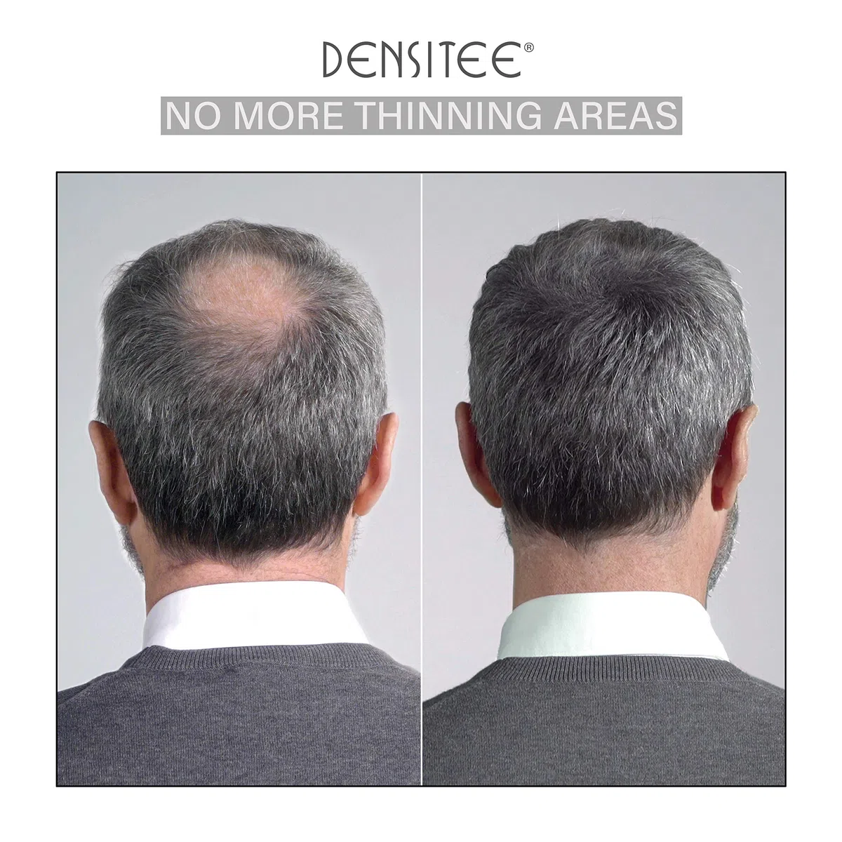 • Fibre di cheratina naturale per ispessimento dei capelli • Densificante e copri calvizie professionale per capelli • 28g • MARRONE SCURO • PLASTIMEA
