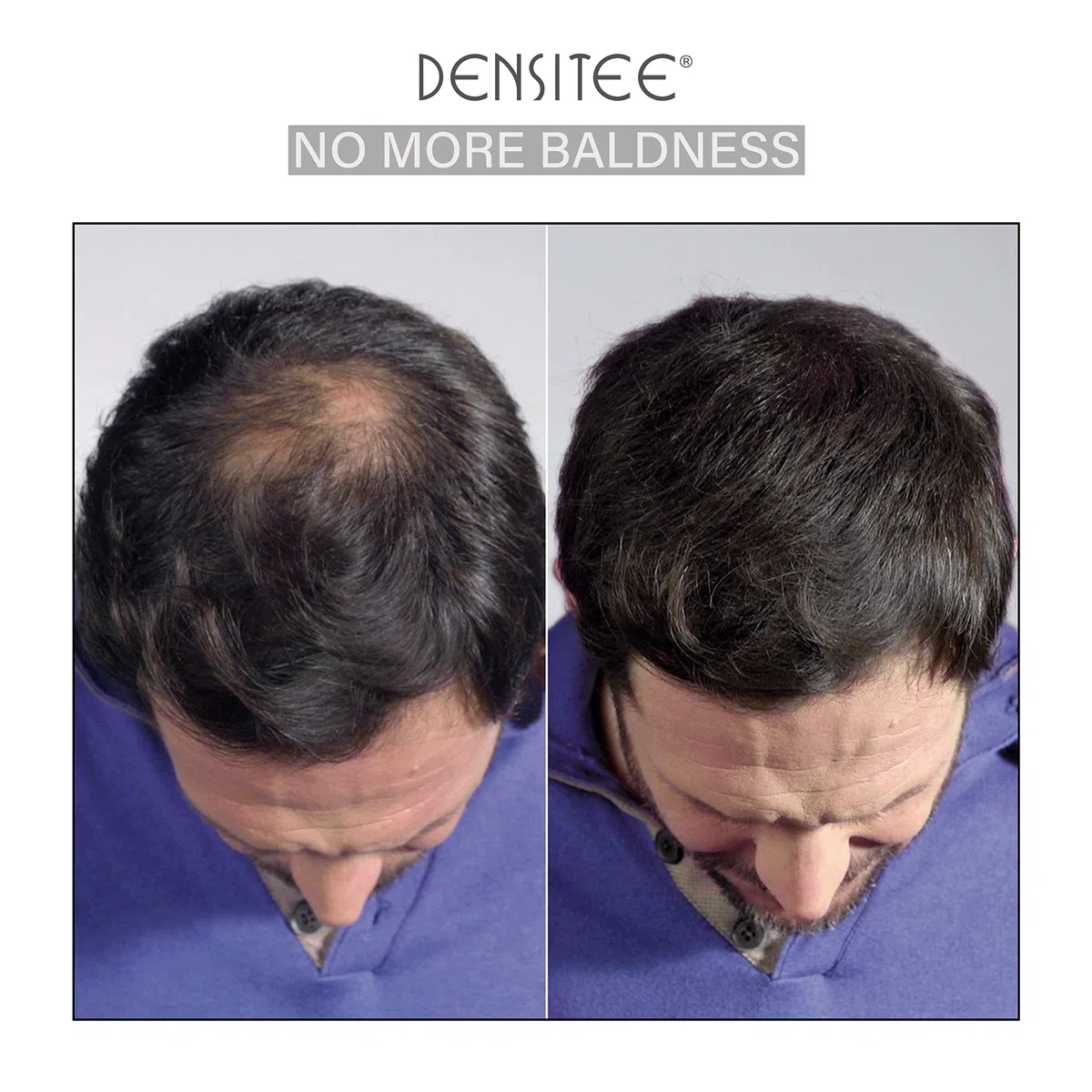• Fibre di cheratina naturale per ispessimento dei capelli • Densificante e copri calvizie professionale per capelli • 28g • MARRONE SCURO • PLASTIMEA