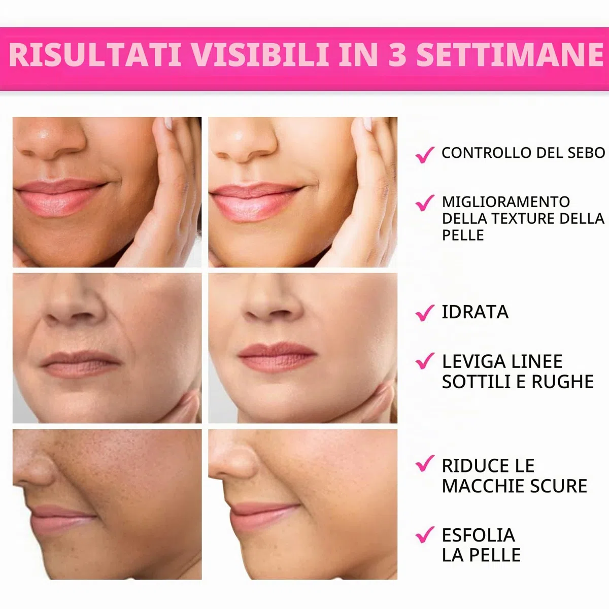 ANAiRUi Dischetti esfolianti all'acido glicolico, Acido glicolico Peel Pads 35% AHA Resurfacing Pad viso, peeling viso per macchie scure, acne, 80 pads