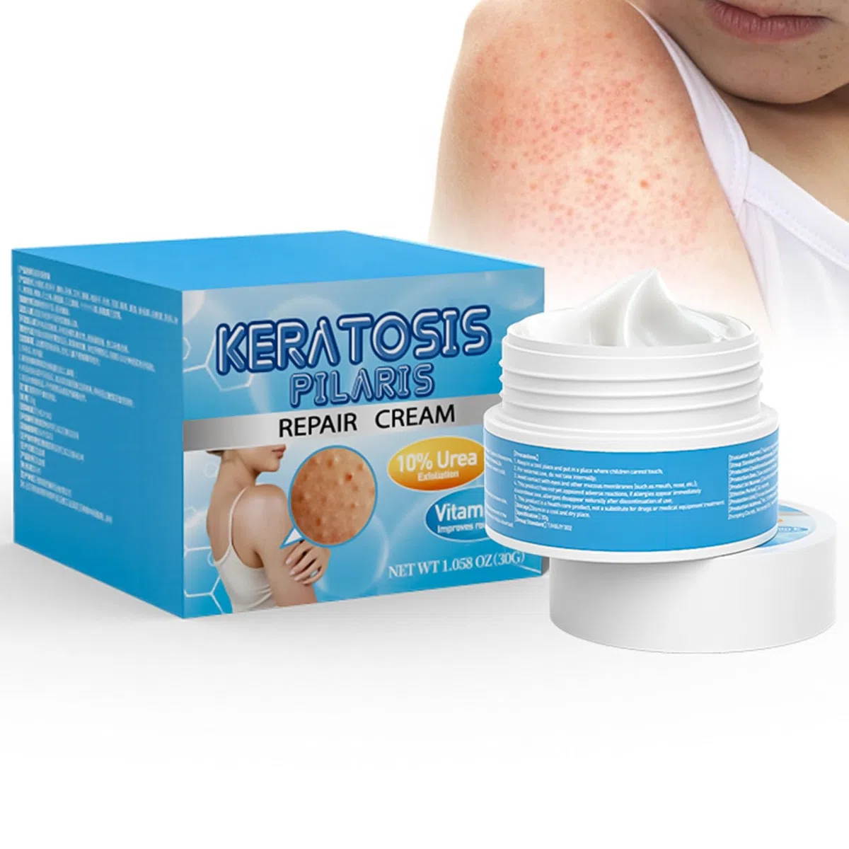 Crema alla Cheratosi, Crema Idratante alla Cheratosi, Soluzione Quotidiana per Della Pelle, Esfoliante Scrub Corpo Contro Cheratosis Pilare, Pelle a Fragola e peli Incarniti 30 G