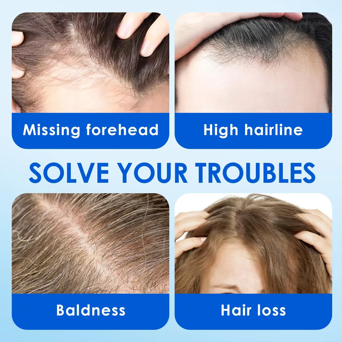 Siero Capelli Crescita Per Uomini e Donne,Essenza Per La Crescita Dei Capelli,Promuovere una Crescita dei Capelli più Spessa,Siero Capelli Crescita Adatto a Tutti i Tipi di Capelli-60ml