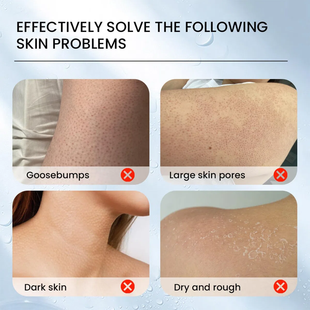 Crema alla Cheratosi, Crema Idratante alla Cheratosi, Soluzione Quotidiana per Della Pelle, Esfoliante Scrub Corpo Contro Cheratosis Pilare, Pelle a Fragola e peli Incarniti 30 G