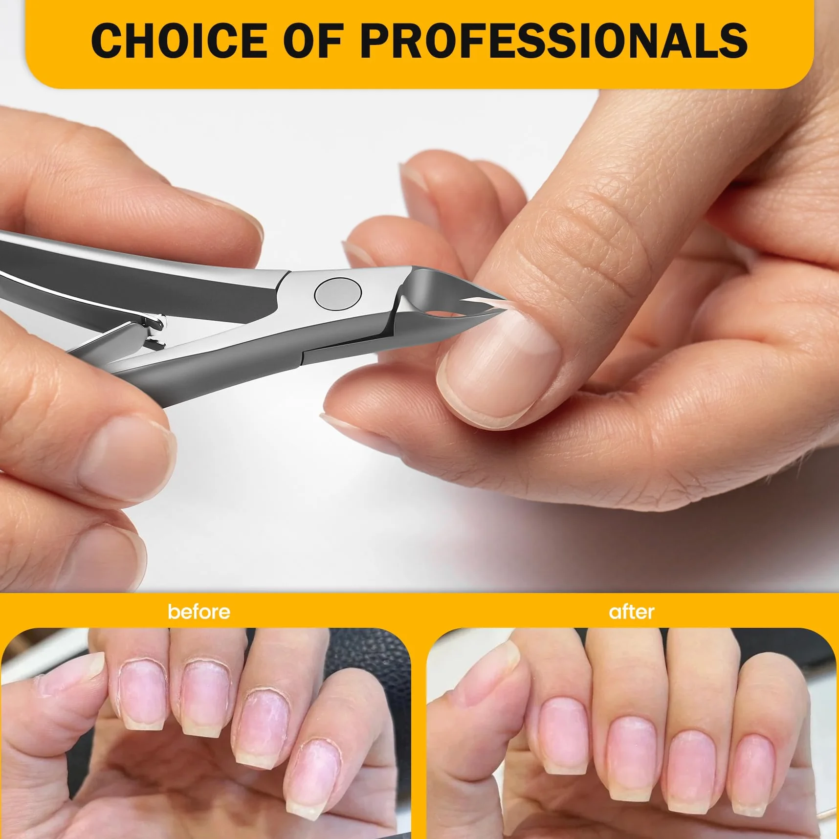 BEZOX Tronchesino Cuticole Professionale in Acciaio Inossidabile cuticola Per Manicure e Piedi, Pinza con Impugnatura Antiscivolo