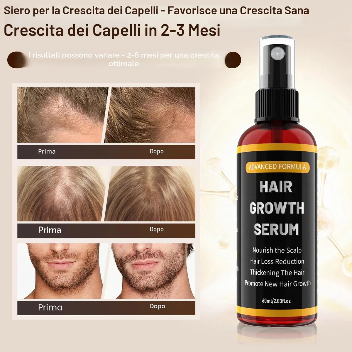 Spray Siero per la Crescita dei Capelli per Uomo e Donna, Accelerare la Crescita dei Capelli, Anticaduta Capelli, con Olio di Rosmarino, Olio di Ricino (Castor Oil) e Biotina, 60 ml