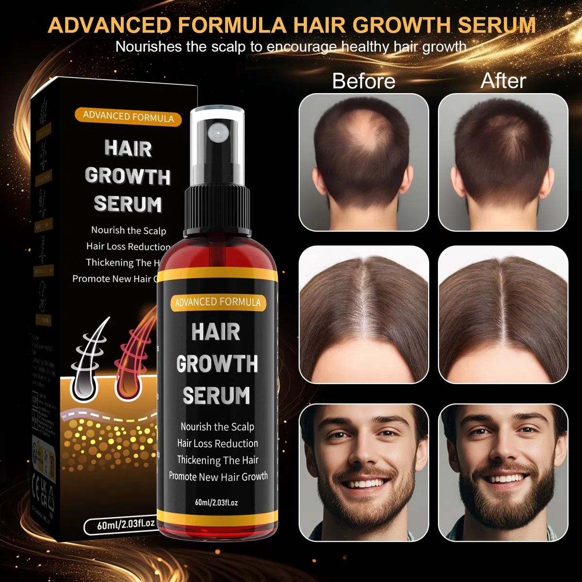 Siero per la crescita dei capelli, spray per uomo/donna, per accelerare la crescita dei capelli, previene la caduta dei capelli, con biotina e rosmarino per olio per la crescita dei capelli, olio per