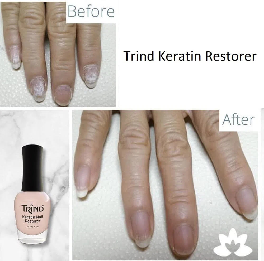 Trind Balsamo Rinforzante alla Cheratina per Unghie, 9 ml