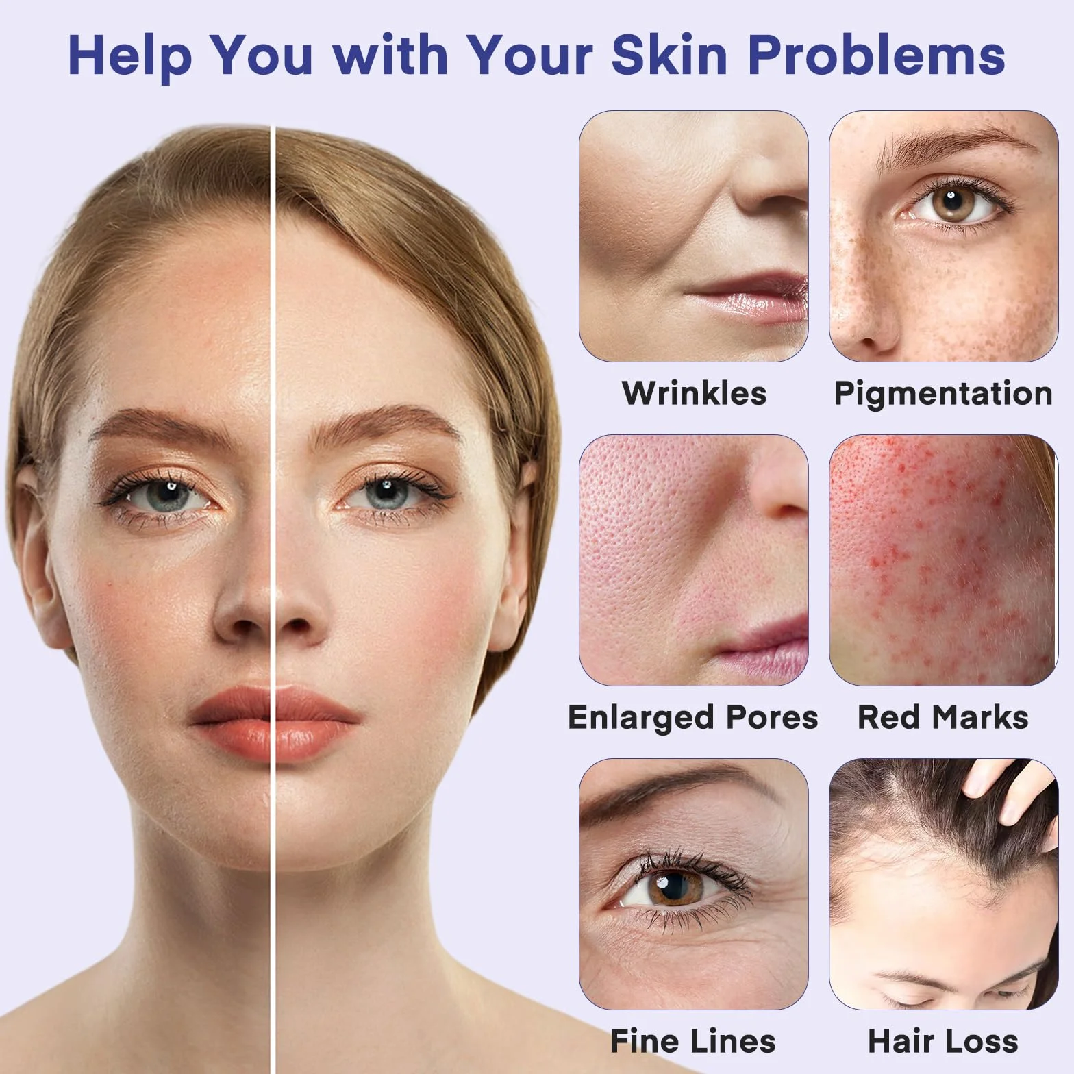 Aghi per microneedling, 10 pezzi a 36 pin di ricambio per Derma Pen Dr.pen Ultima A6, 10 pezzi/confezione