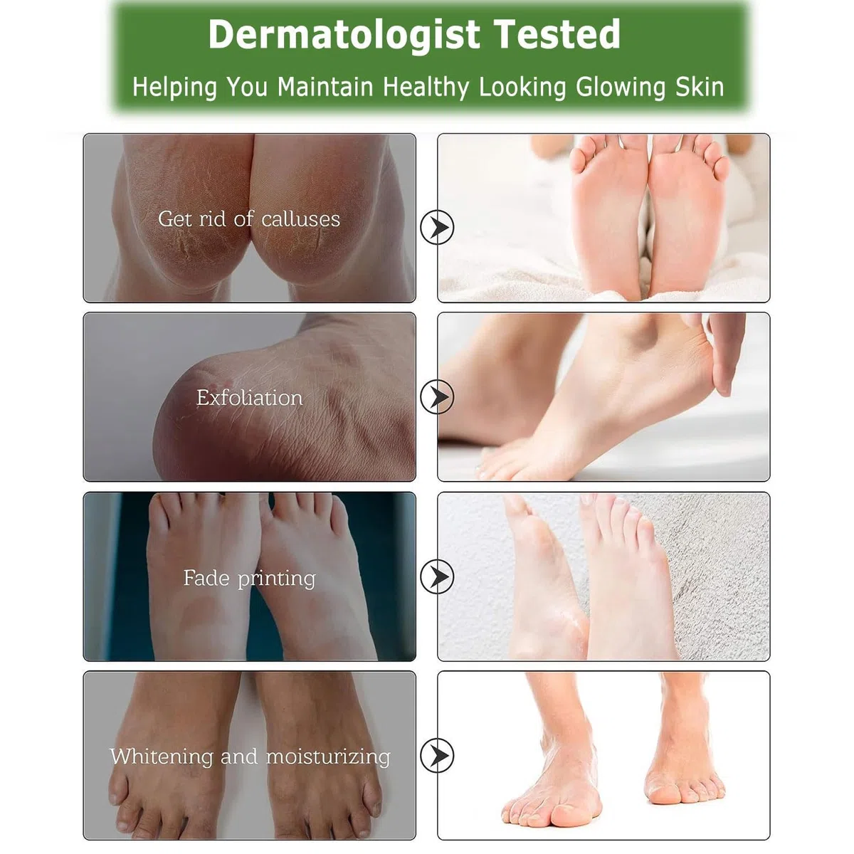 Maschera Piedi Esfoliante | Trattamento Calli e Duroni | Cura e Scrub Piedi | Peeling Piedi Forte | Pulizia Talloni Screpolati | Foot Peel Mask Calzini Pedicure Peel Off | Pesca 5 Paia