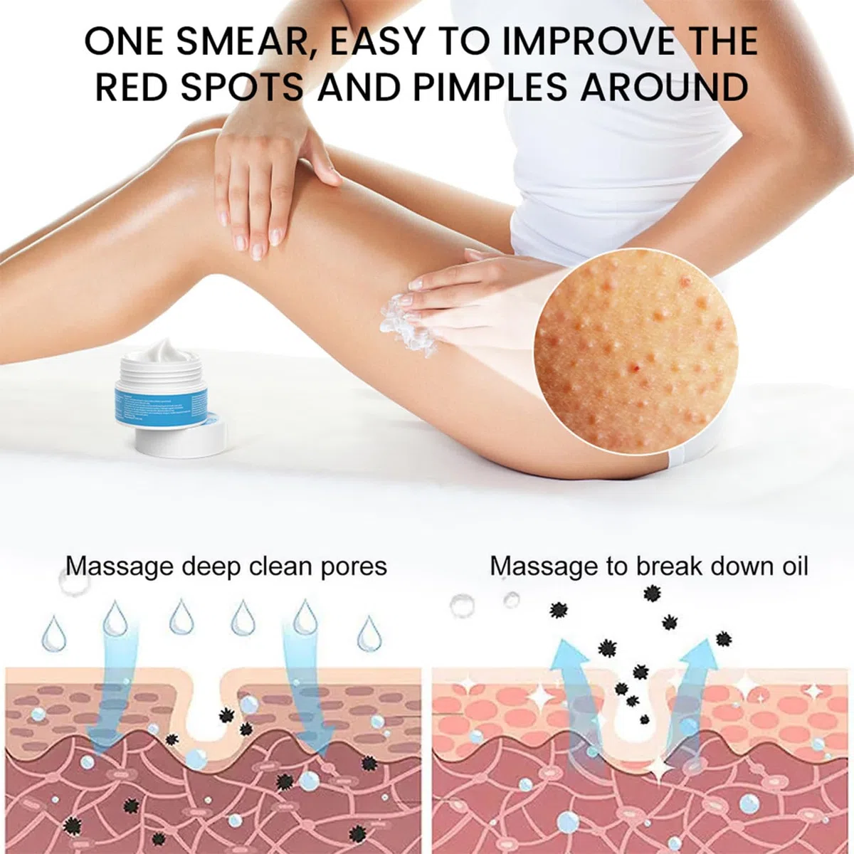 Crema alla Cheratosi, Crema Idratante alla Cheratosi, Soluzione Quotidiana per Della Pelle, Esfoliante Scrub Corpo Contro Cheratosis Pilare, Pelle a Fragola e peli Incarniti 30 G