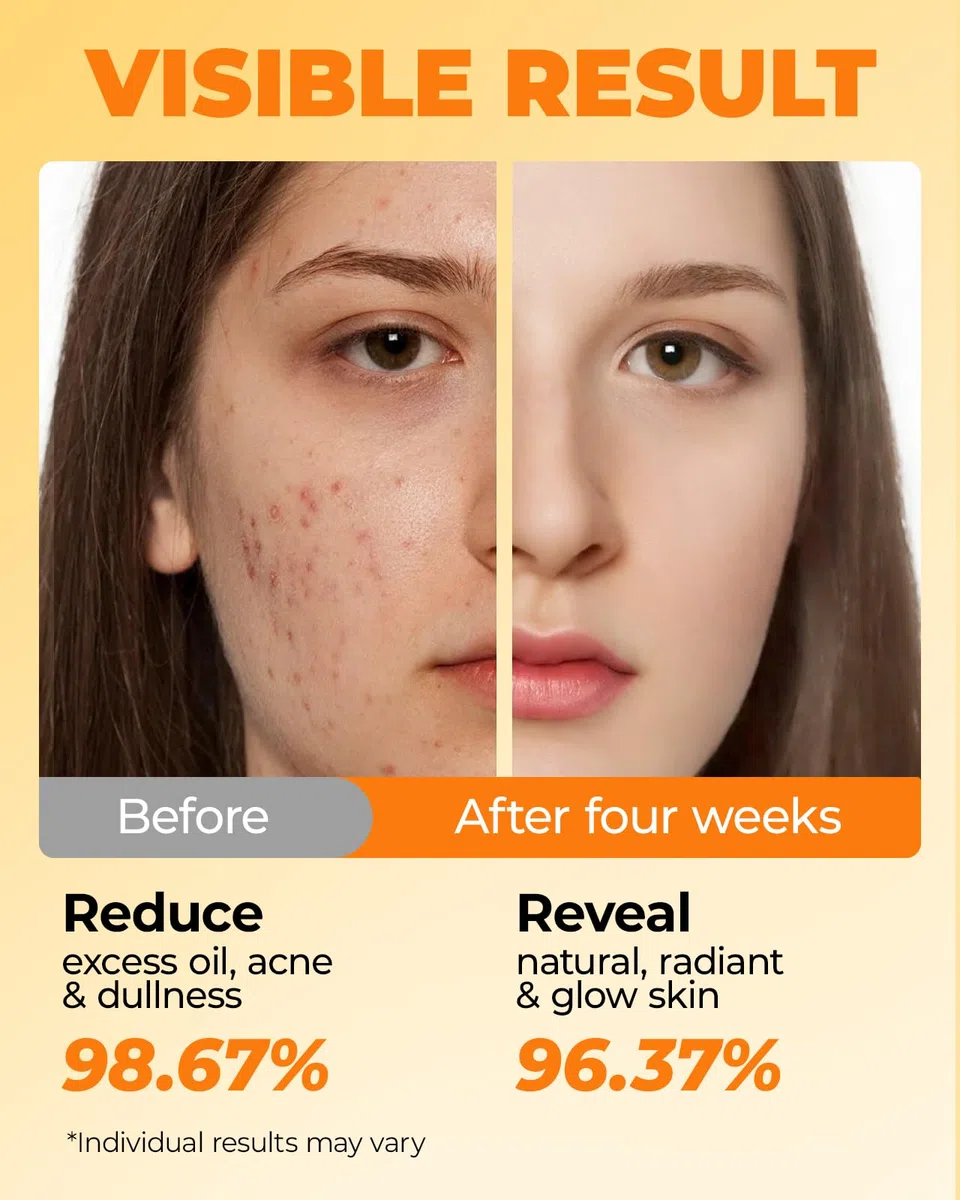 LA.PERSONAL Dischetti Detergenti, Dischetti Pulizia Viso, per Brufoli e Punti Neri, Pad Esfolianti Curcuma, per Macchie Scure, Pelle Opaca & Sbloccare i Por, Liscio e Luminoso, 50 Pezzi