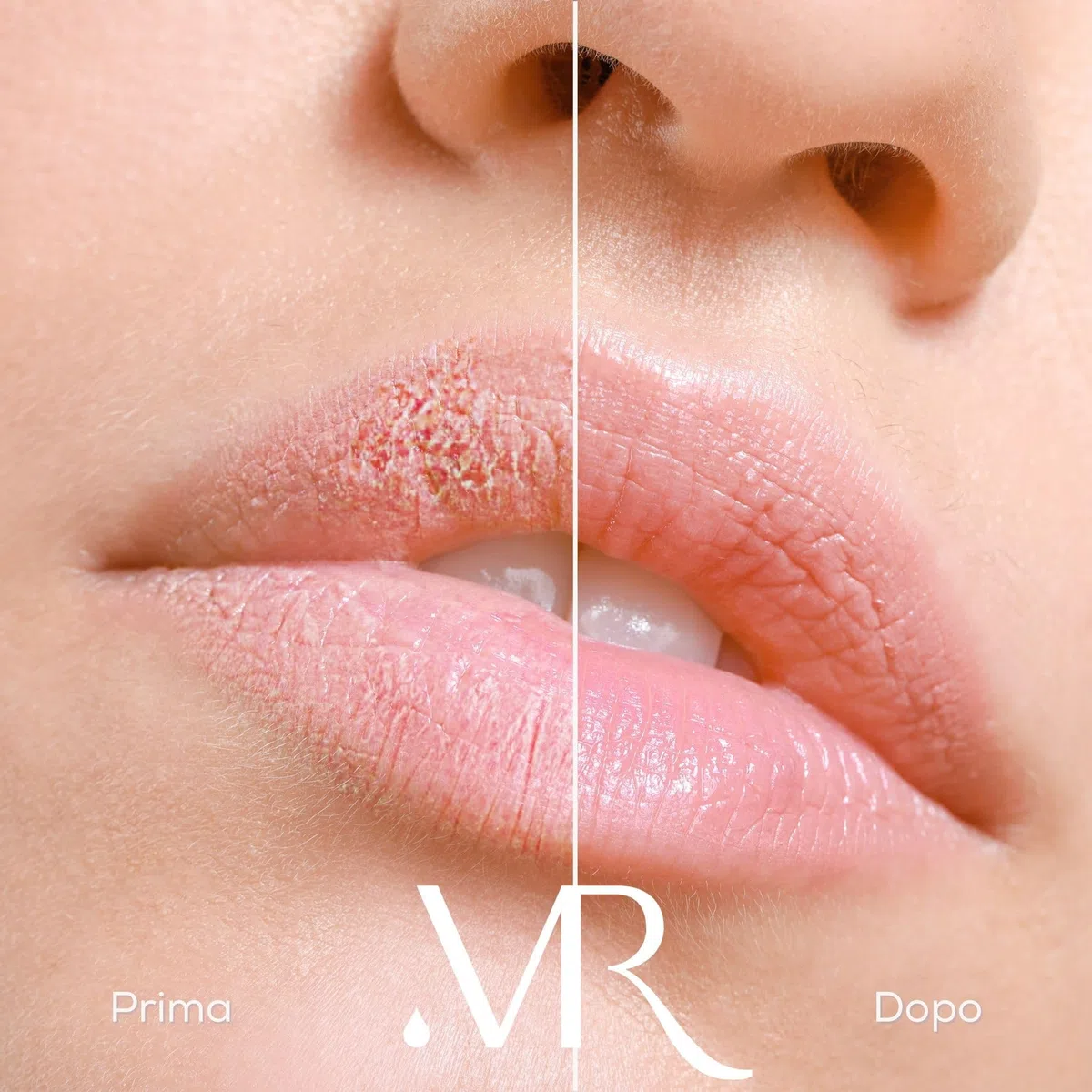 MyLip Scrub Labbra - Levigante con Microsfere di Riso, Olio di Oliva e Burro di Karité, Esfoliazione e Idratazione Naturale by Dr. Maurizia Furno