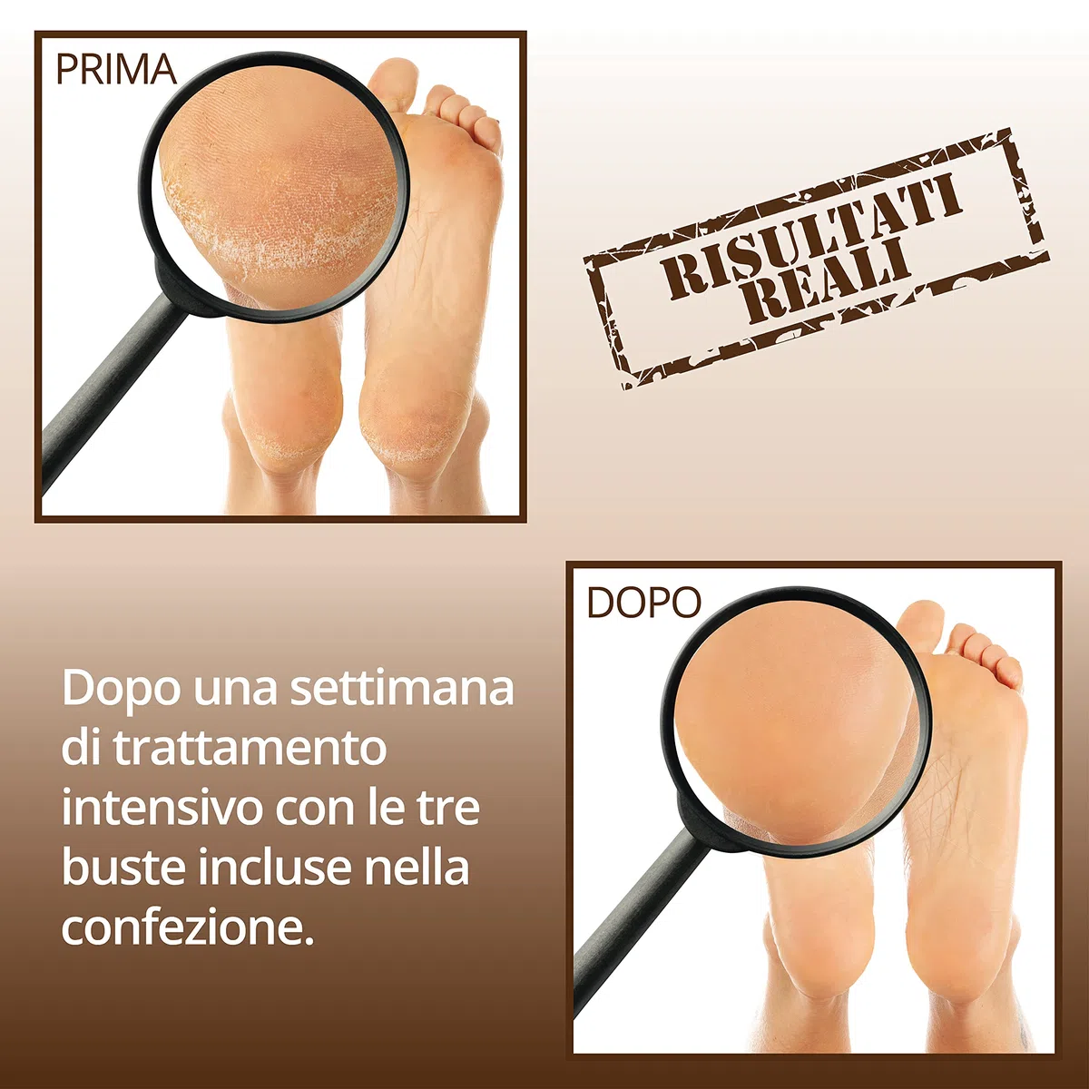 Maschera Piedi Idratante trattamento piedi secchi screpolati calzino calli e duroni 3 paia