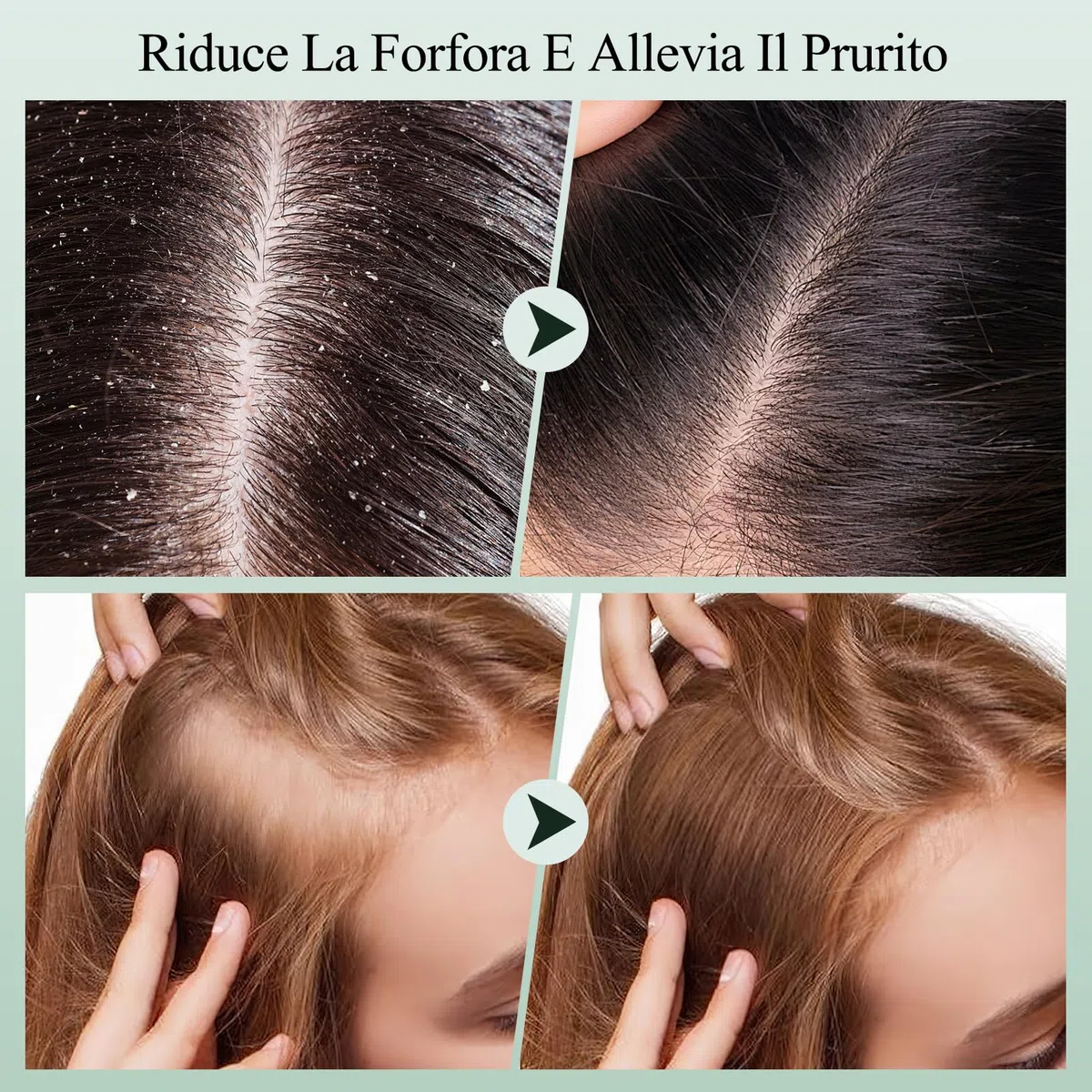 Scrub del cuoio capelluto, shampoo scrub del cuoio capelluto al rosmarino, trattamento 2 in 1 del cuoio capelluto con olio di menta, trattamento per capelli per chiarire e rimuovere i depositi con