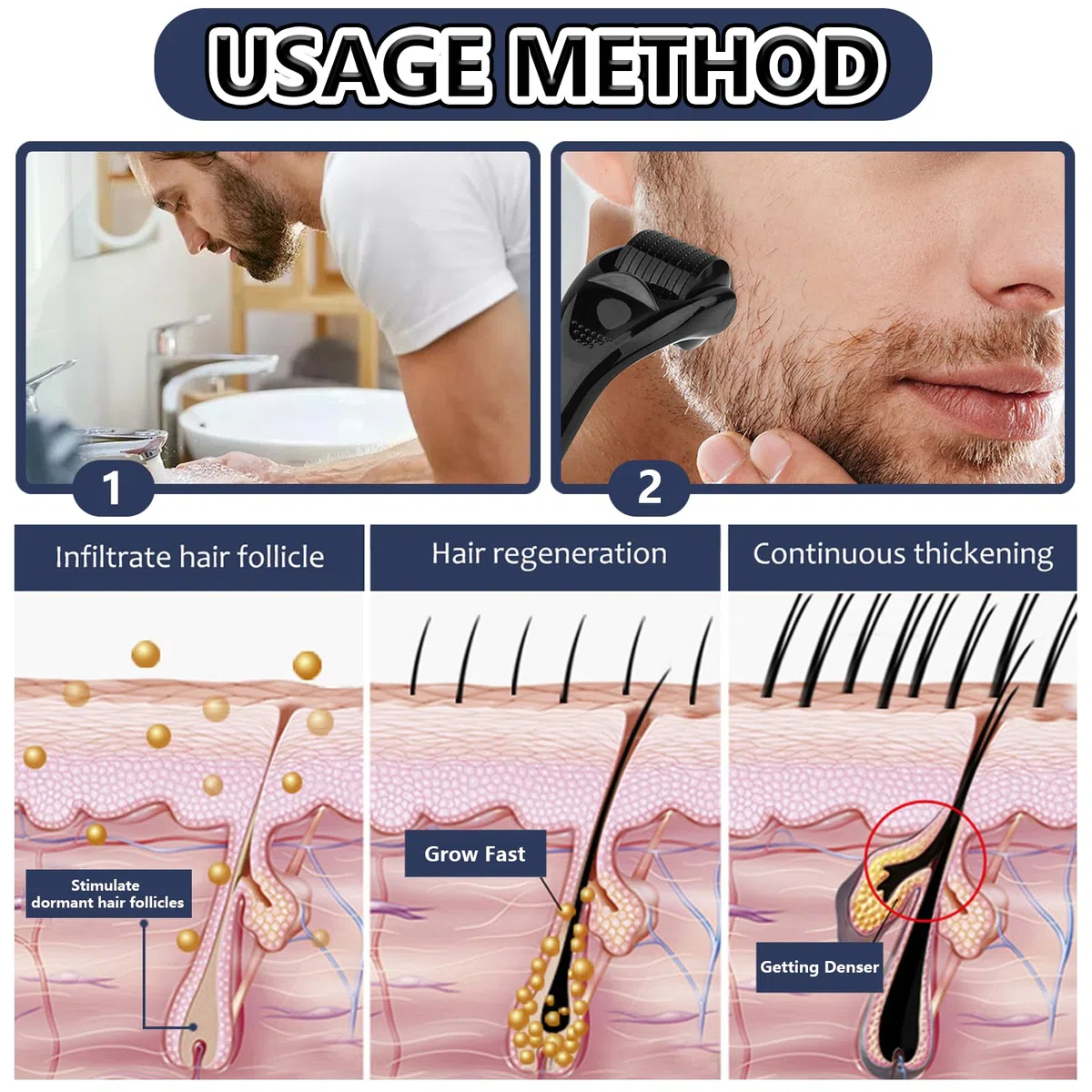 Whaleo Dermaroller Capelli Professionale Micro Rullo, 0,5/1/1,5/2mm Dermaroller Viso,Microneedling Viso,Beard Roller,Micro Rullo para Crescita Barba,Perdita Capelli Delle Rughe Cicatrici Smagliature