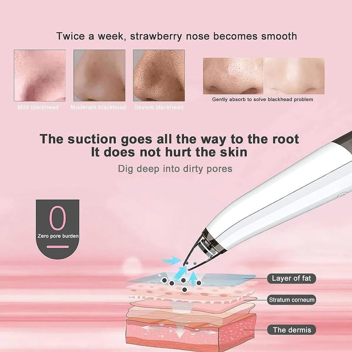 Pore Extractor for Blackhead Removal - Pimple Extractor for Facial Cleansing, Blackhead Suction Tool, Facial Pore Cleaner, Tool for Pu Extractor
